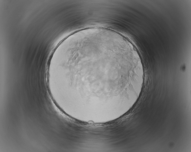 X0000115171143200912091017