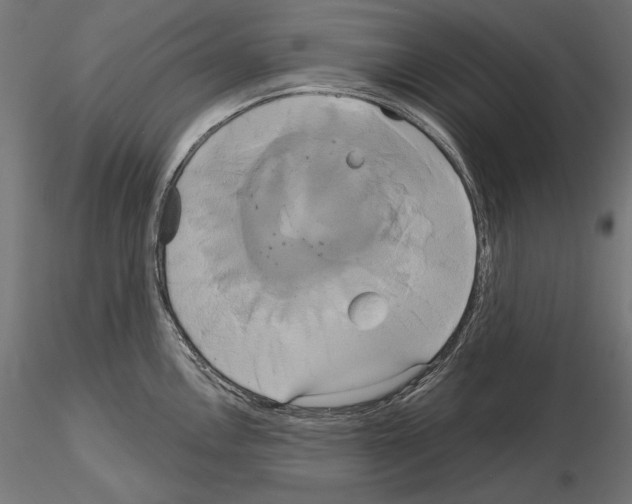 X0000115171146200912091017