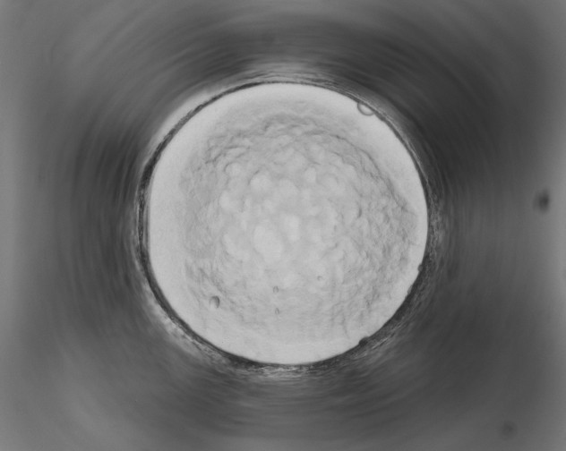 X0000115171147200912091017