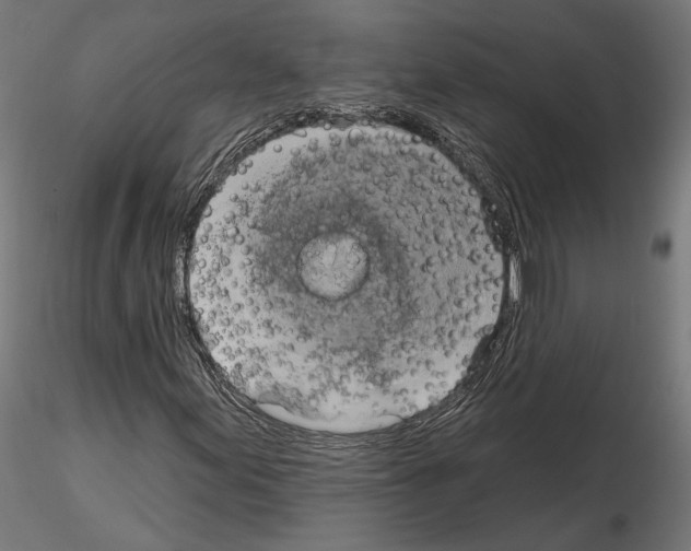 X0000115171155200912091016