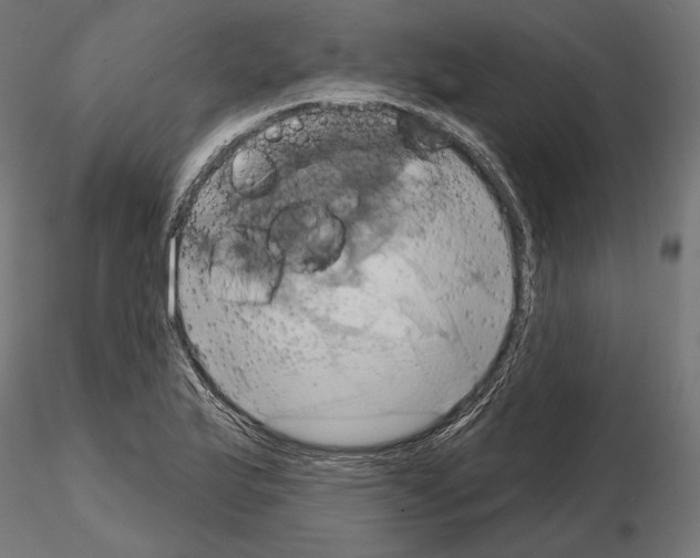 X0000115171175200912091016