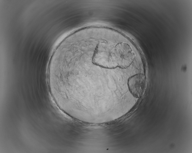 X0000115171199200912091016