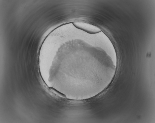 X0000115171200200912091016