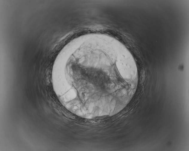 X0000115171205200912091015