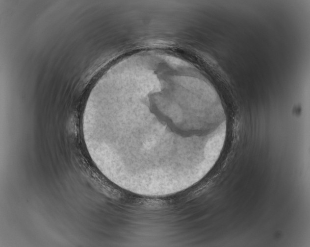 X0000115171209200912091015