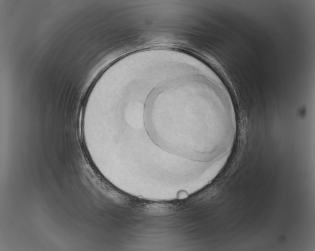 X0000115171227200912091015