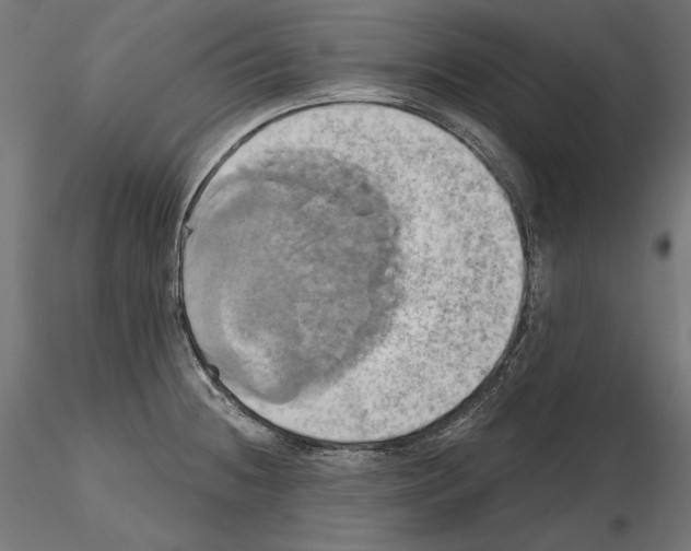 X0000115171236200912091015