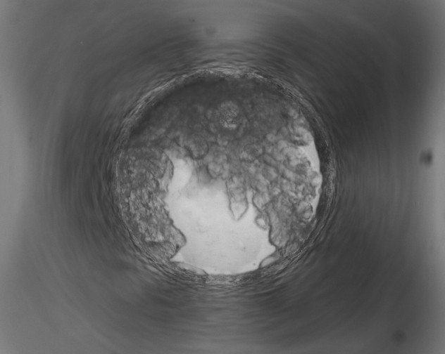 X0000115171297200912091014