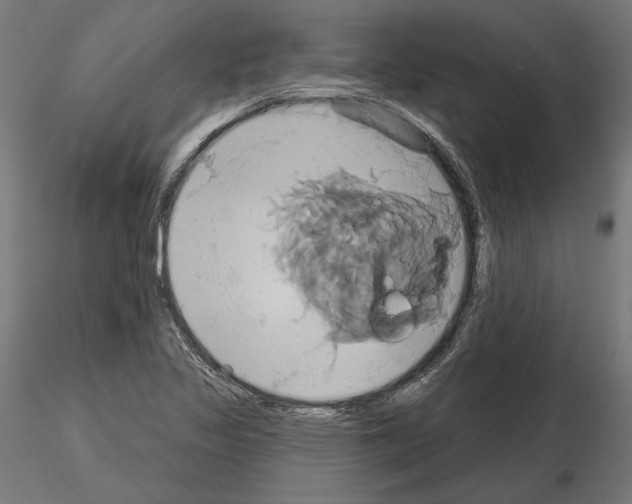 X0000115171317200912091014