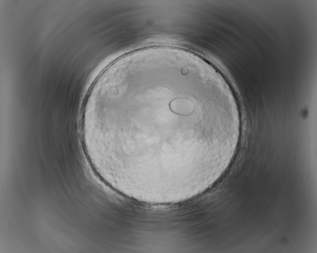 X0000115171339200912091014