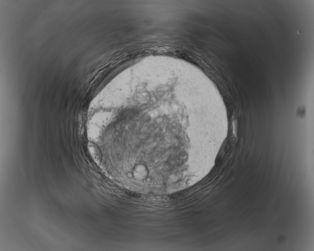 X0000115171347200912091014