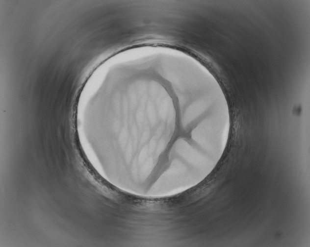 X0000115171375200912091013