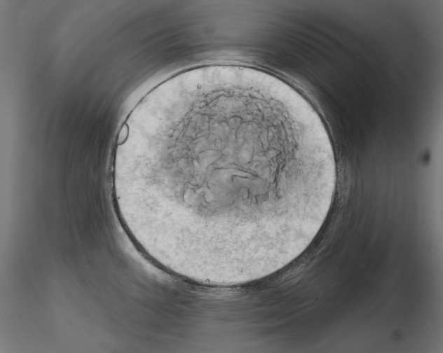 X0000115171387200912091013