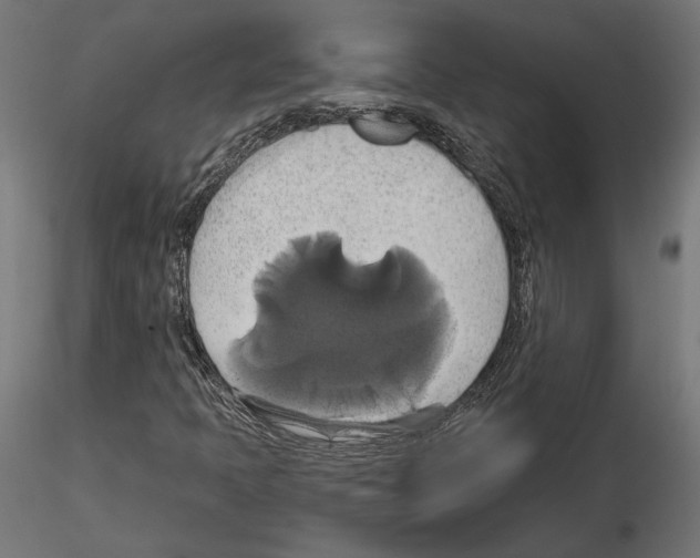 X0000115171397200912091012