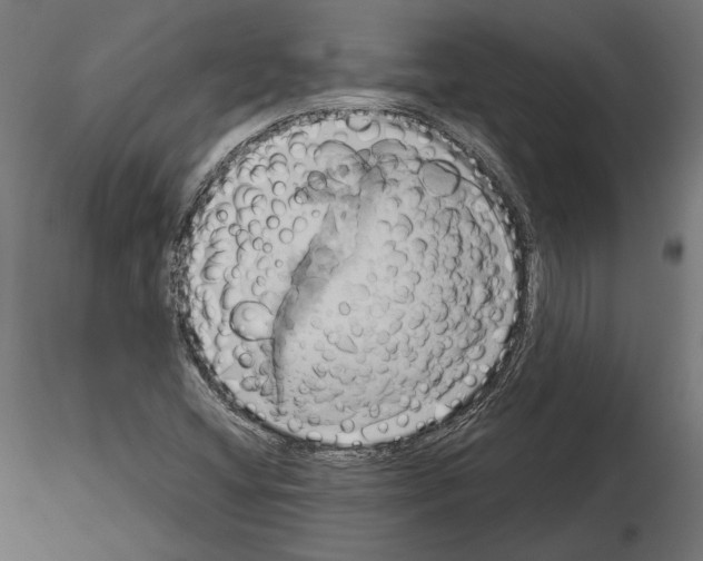 X0000115171404200912091012