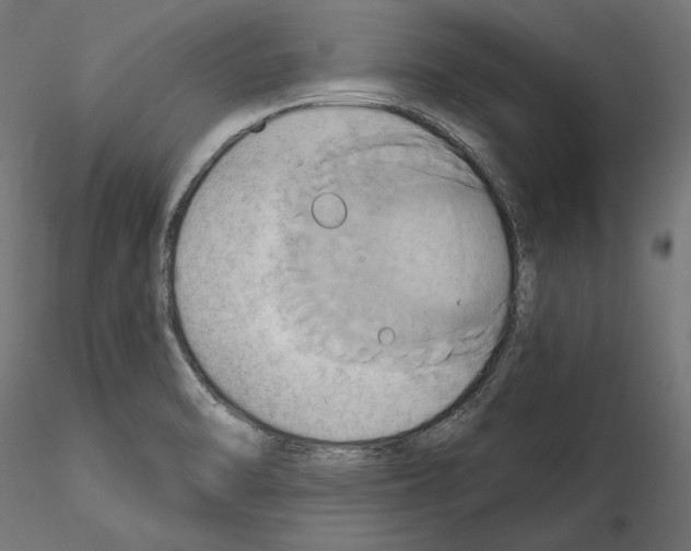 X0000115171470200912091012