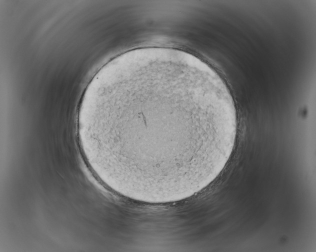 X0000115171479200912091011