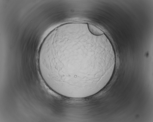 X0000115171486200912091011