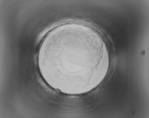 X0000115171503200912091011