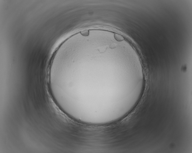 X0000115171514200912091011