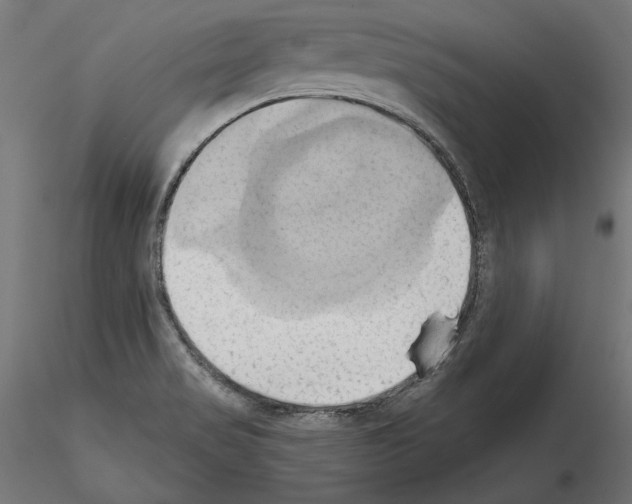 X0000115171517200912091011