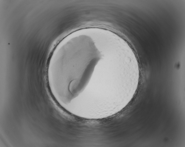 X0000115171525200912091011