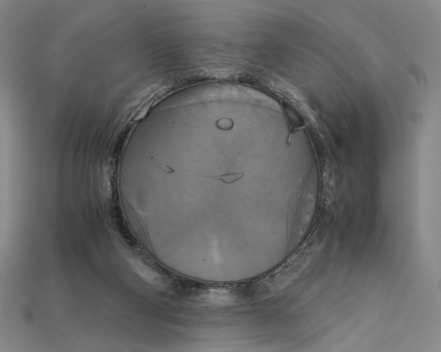 X0000115180114200911121809