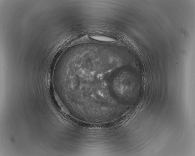 X0000115180644200911121801