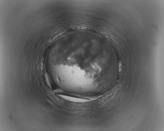 X0000115181011200911121756