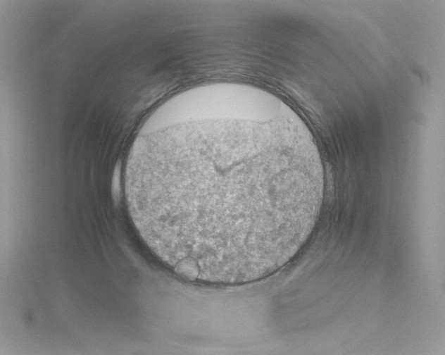 X0000115180028200911181436