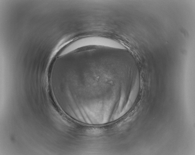 X0000115180198200911181434