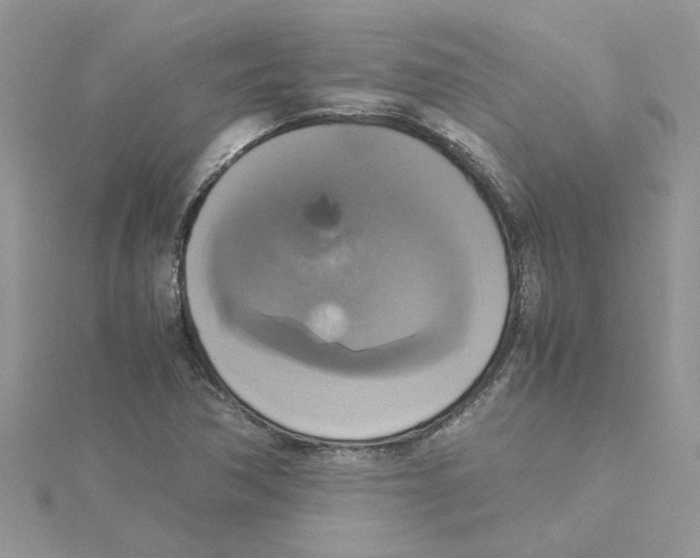 X0000115181362200911181418