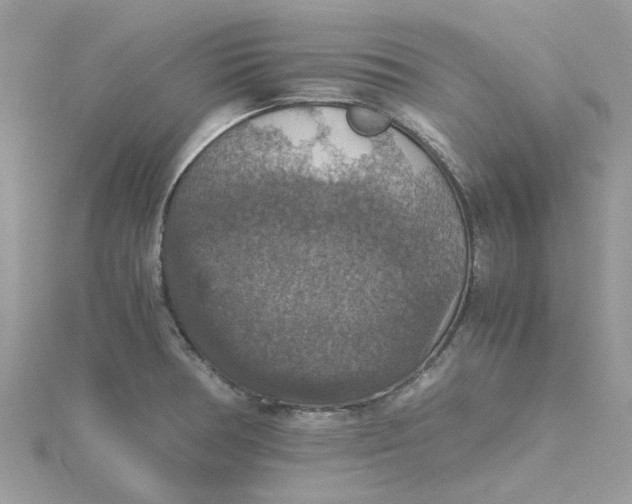 X0000115181378200911181418
