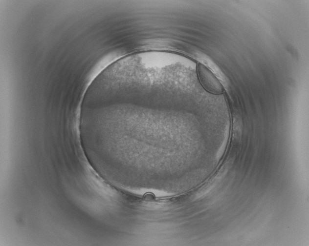 X0000115181386200911181418