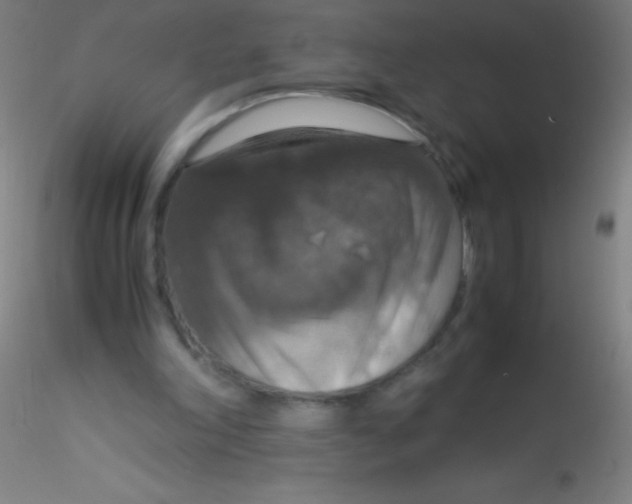 X0000115180198200911251404