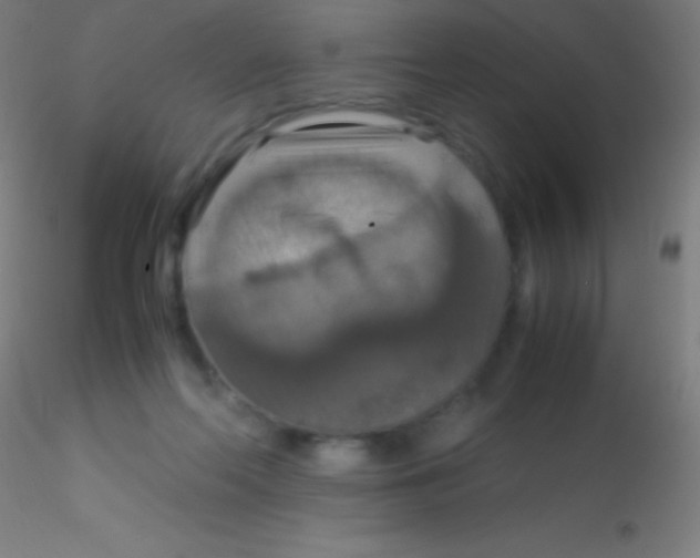 X0000115180214200911251404