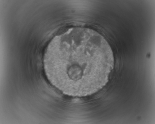 X0000115180616200911251358