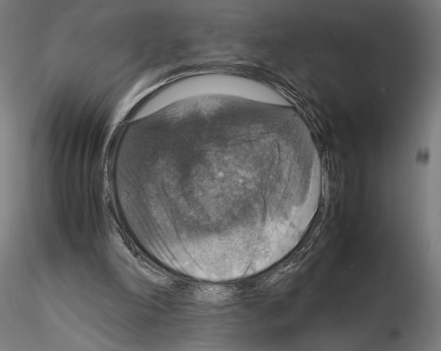 X0000115180198200912091055