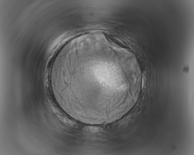 X0000115180339200912091052