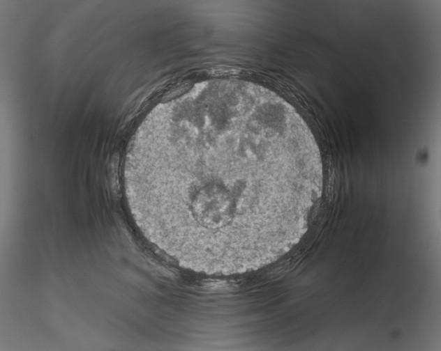 X0000115180616200912091049