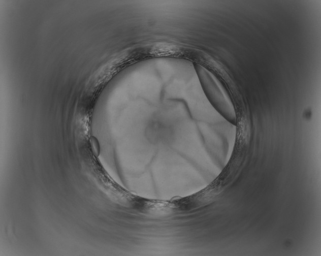 X0000115180621200912091048