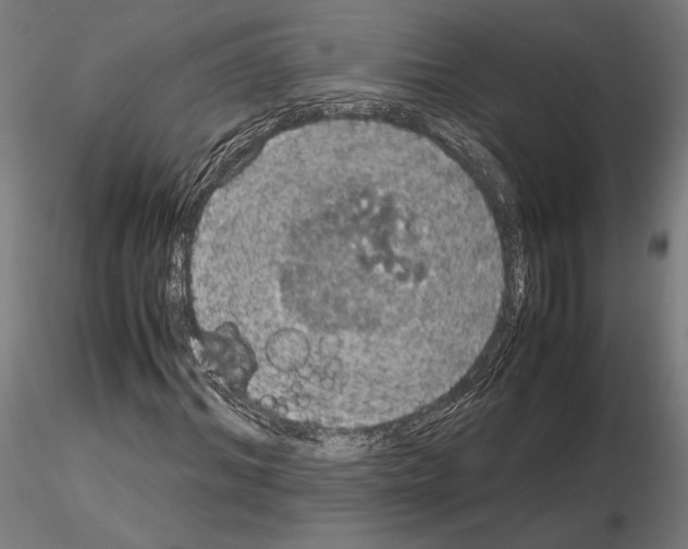 X0000115180964200912091043