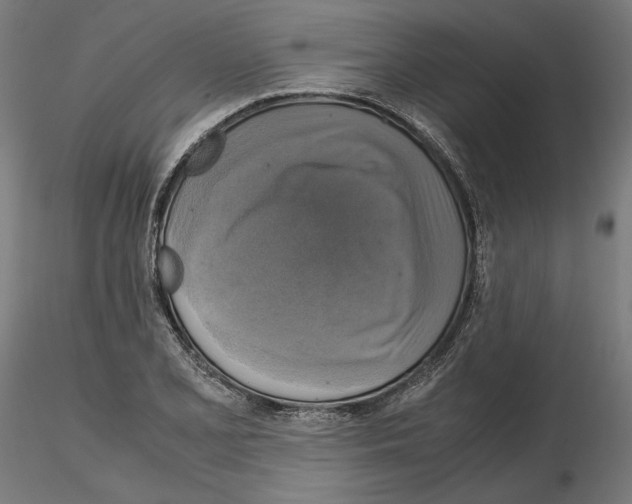 X0000115181077200912091041