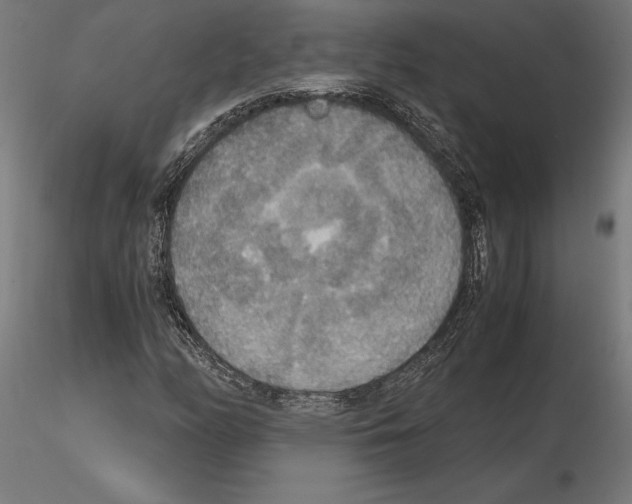 X0000115181158200912091040