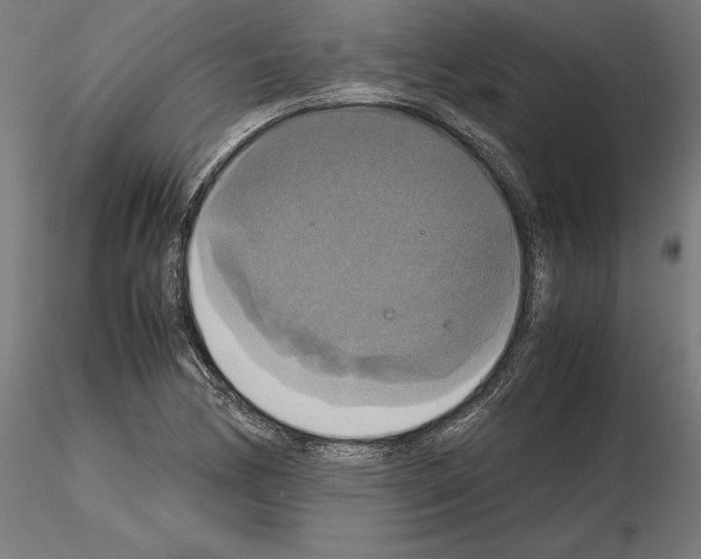 X0000115181170200912091040