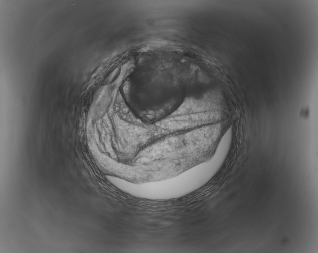 X0000115181397200912091036