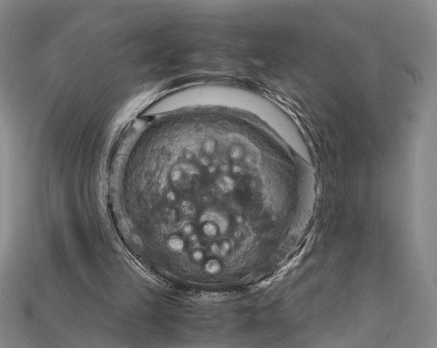 X0000115190149200911121828
