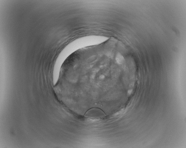 X0000115190139200911181456