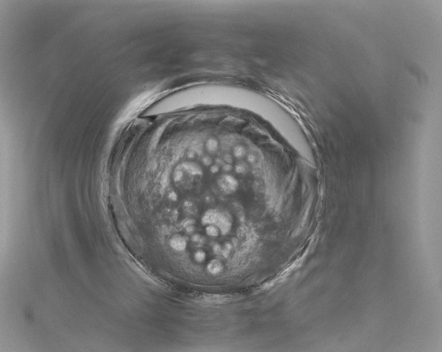 X0000115190149200911181455