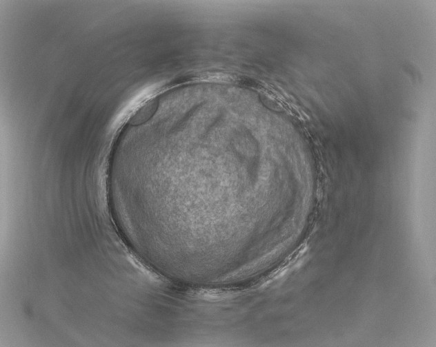 X0000115190341200911181452